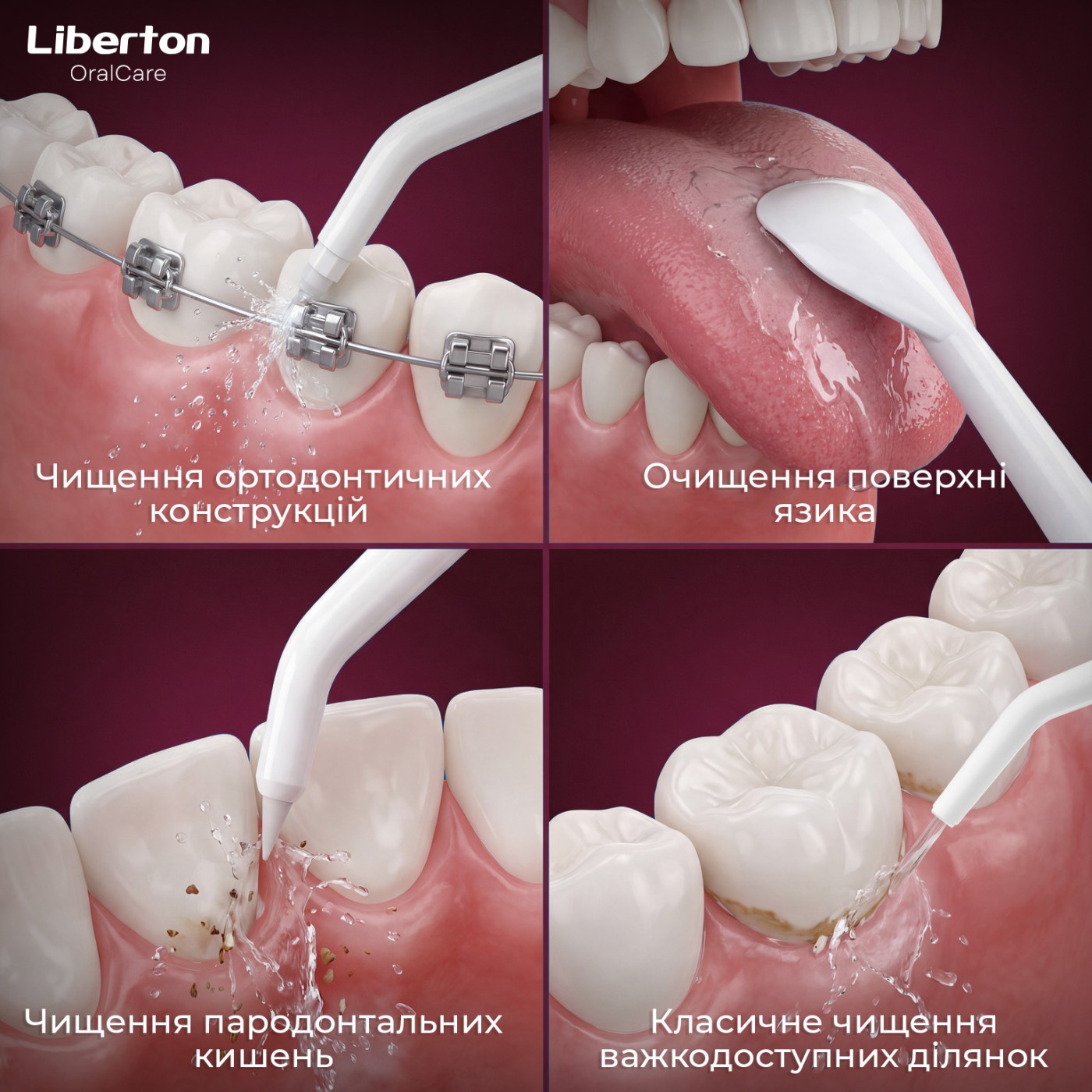 Oral irrigator LIP-7300